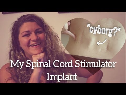 abbott spinal cord stimulator