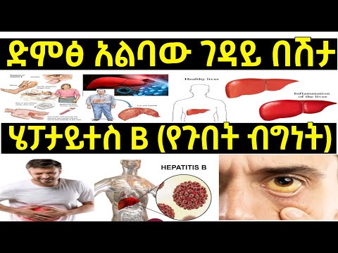 ቪዲዮ: የዞይ ብራድሌይ አንስታይ እና የሚያምር ውበት