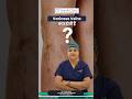 What Are #vericoseveins? Symptoms & Treatments Explained by an IR Expert | Dr. Parul Garg