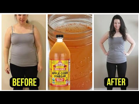 apple-cider-vinegar-for-weight-loss-|-benefits-of-acv-|-acv-recipes-and-side-effects