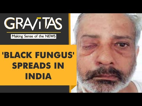 Gravitas: What is Black Fungus or Mucormycosis?