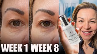 Aeonia ‘age defying’ serum review | My before and after results after trying new 'super ingredient' by The Honest Channel 7,201 views 1 month ago 11 minutes, 29 seconds