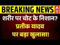 Prateek Yadav Death News: अभी-अभी प्रतीक यादव पर आई बड़ी खबर | Latest News | Top News | Breaking