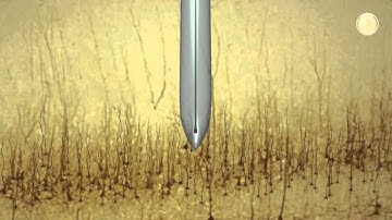 Electrode implantation