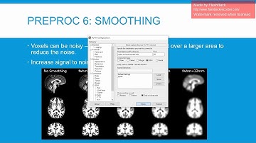 preprocessing fmri data in SPM12