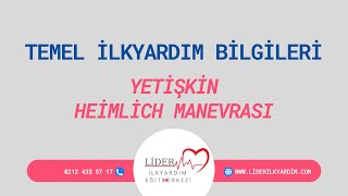 Temel İlkyardim Bi̇lgi̇leri̇ - Yeti̇şki̇n Hava Yolu Tikanikliği Hei̇mli̇ch Manevrasi