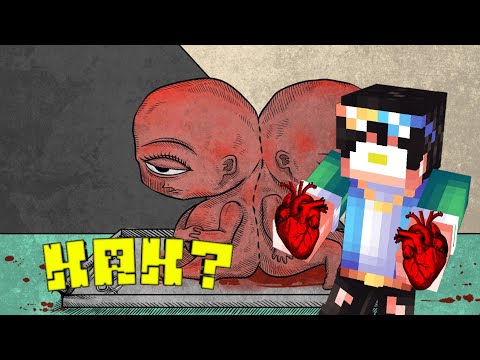 Одноглазого мальчика поймали рыбы! Life Gallery!