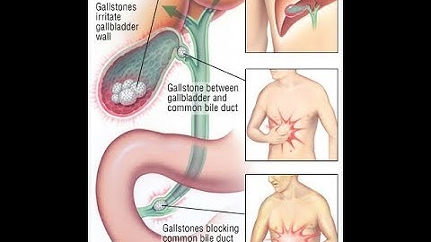 well im home again after hopefully second last surgery one more to go sorry for my absence