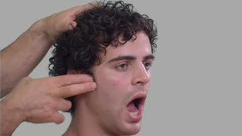 Oppervlakte-anatomie van het hoofd