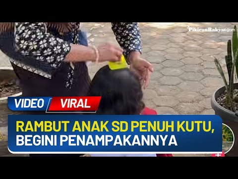 Merinding, Rambut Anak SD Ini Penuh Kutu, Videonya Viral