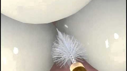 Easy Brush Cleaners by DenTek