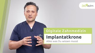 Implantatkrone - Alles was Du wissen musst | 360°zahn