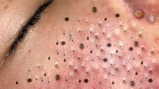 𝐂𝐡𝐢𝐥𝐥 𝐘𝐨𝐮𝐫 𝐋𝐢𝐟𝐞 𝐖𝐢𝐭𝐡 𝐋𝐍𝐆 𝐒𝐤𝐢𝐧 𝐂𝐚𝐫𝐞 # #6255