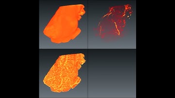 Comparaison of RORPO against Frangi