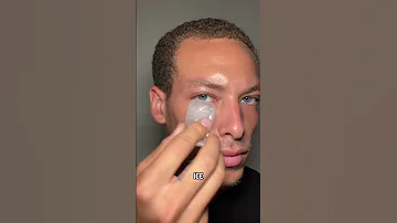 Getting Rid Of Eye Bags 