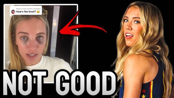 New Footage Shows Lexie Hull's Head INJURY Is Even WORSE Than We Thought...