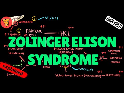 ZOLINGER-ELISON SYNDROME Pathogenesis Diagnosis Treatment