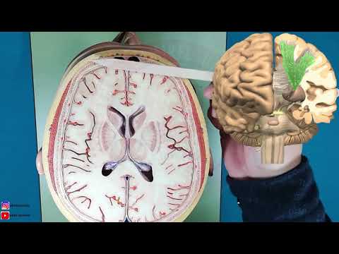 Substantia Alba Telencephali (Beyaz Cevher: Corpus Callosum, Capsula Interna, Commissura...)