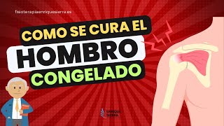 ¿CÓMO SE CURA UN HOMBRO CONGELADO? ✅ QUÉ ES, SÍNTOMAS, CAUSAS, EJERCICIOS Y TRATAMIENTO.