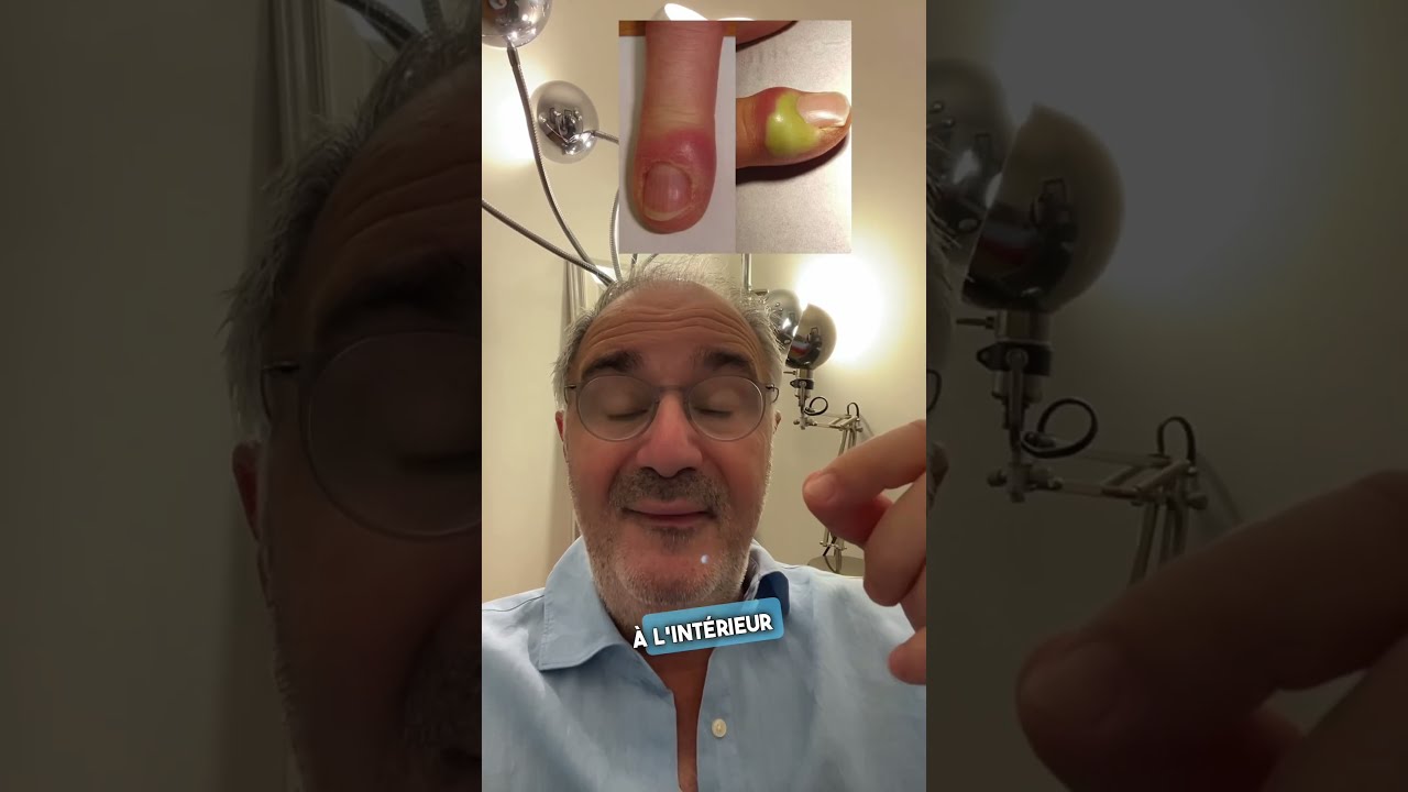 Le panaris, ca n’est pas le pied…#infection #health #santé #medecine