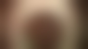 Surgery: Capsular Tension Segment (CTS) Surgical Technique for Dislocated Cataract