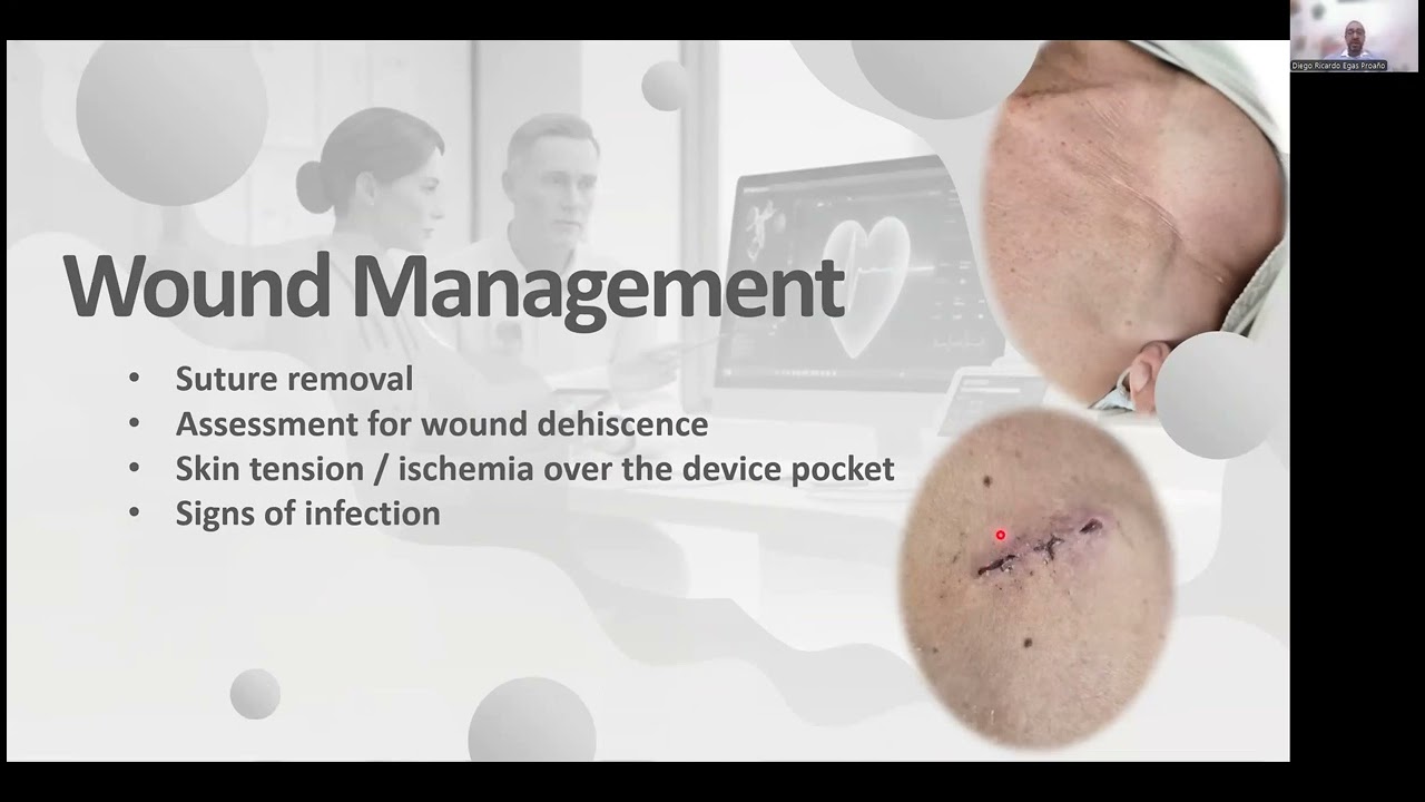 Patient Follow Up – Bradyarrhythmia Education Program