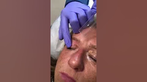 Xanthelasmata - PLEXR Video