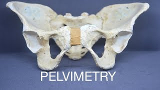 PELVIMETRY