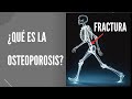 ¿Qué es la osteoporosis?