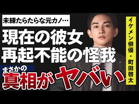 町田啓太の未練のある元カノや現在の彼女の正体がヤバすぎた…！「テッパチ!」の主演で有名な俳優の再起不能とされる大怪我に驚きを隠せない…！