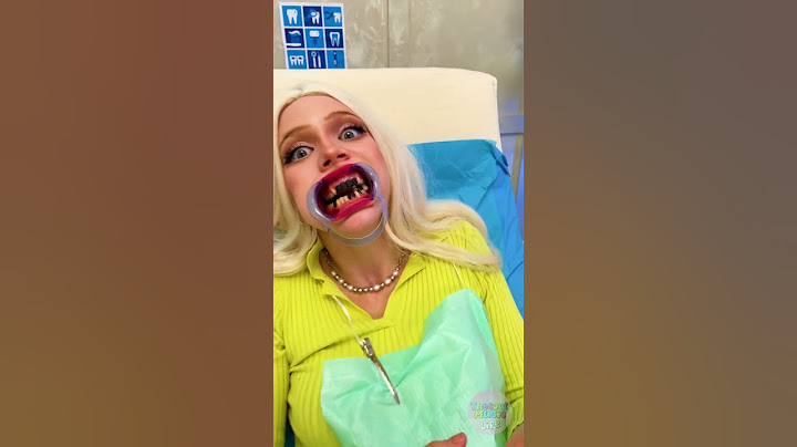 My Teeth Fell Out 😨 Tic tac Dentist Prank