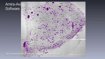 Mouse tissue segmentation with Amira Software