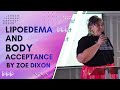 Lipoedema &amp; Body Acceptance ✨