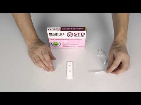 Video: Hepatitis C-antilichaamtest: Hoe Werkt Het?