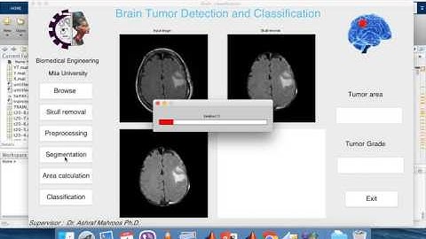 Brain Tumor Detection and Classification