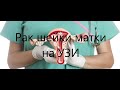 Рак шейки матки