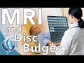 MRI Findings of Disc Bulge