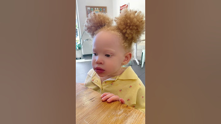 Vilken typ av #albinism har Zayana? #albinismmedvetenhet #albinismärvacker #albino