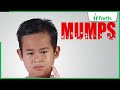 Learn about Mumps: Symptoms, Causes, and Treatments with Dr. Neetu Talwar