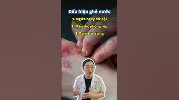 5 Dấu hiệu nhận biết bệnh nhân bị ghẻ nước - Ds Hằng Eduphar #eduphar #duocsi #hocbanthuoc