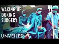 What If You Wake Up During Brain Surgery? | Unveiled