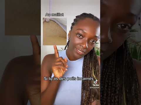 Vidéo: 4 façons de prévenir les poils incarnés