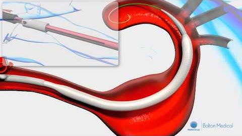 Relay Deployment Tecnique