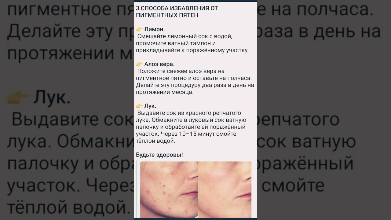 ⁣З СПОСОБА ИЗБАВЛЕНИЯ ОТПИГМЕНТНЫХ ПЯТЕН #здоровье #питание #заздоровье #заботаосебе #народнаямедицин