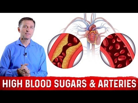 the-effects-of-high-blood-sugars-on-your-arteries