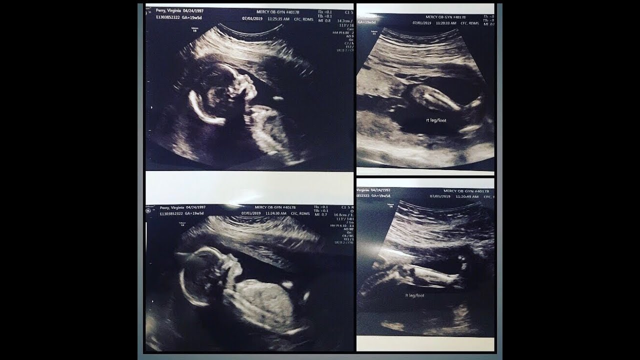 Gender Reveal! BOY OR GIRL!?!?!