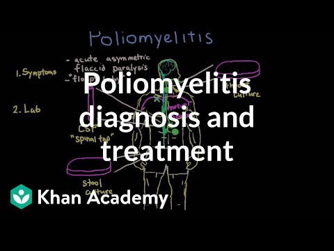 Poliomyelitis diagnosis and treatment | Infectious diseases | NCLEX-RN | Khan Academy