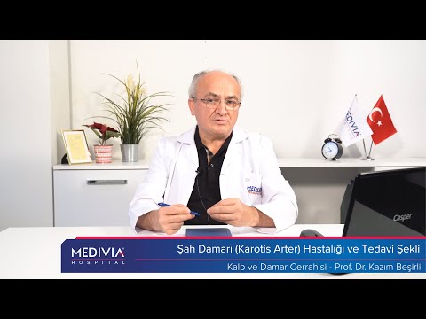 Şah Damarı Karotis Arter Hastalığı ve Tedavi Şekli - Prof. Dr. Kazım Beşirli