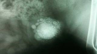 Download Lagu Infected Bladder Psy Mix - DJ Kontol MP3