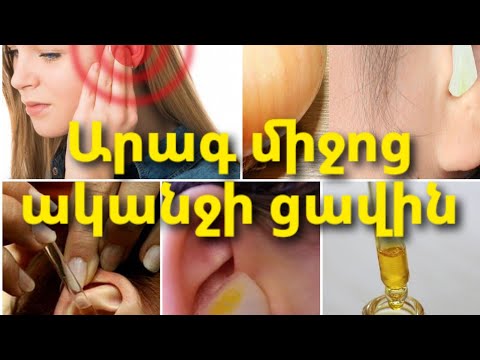 Video: Ինչպես քայլել (նկարներով)